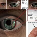 Smart Contact Lenses for Glucose Monitoring